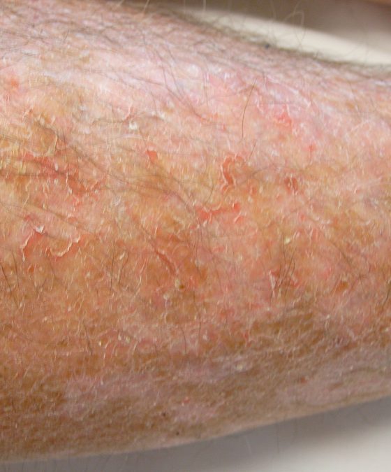 Read Now for Natural Skin Winterproofing Tips!