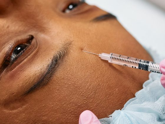 Surprising Botox Facts You Need to Know: Five Eye-Opening Revelations