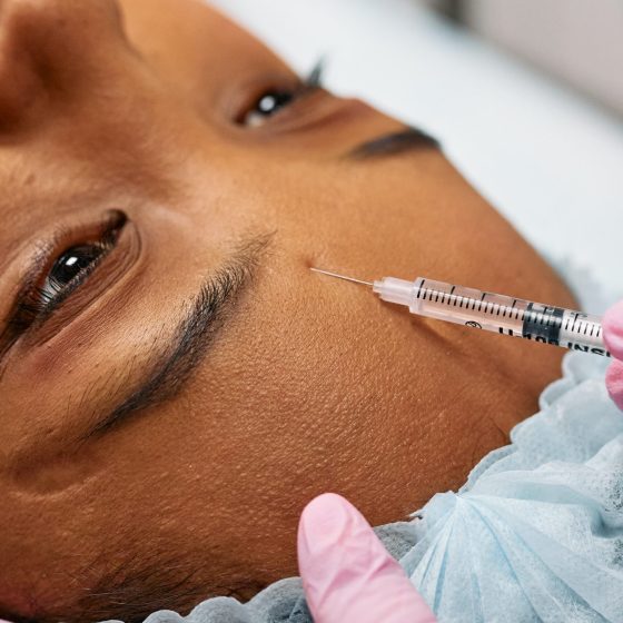 Surprising Botox Facts You Need to Know: Five Eye-Opening Revelations