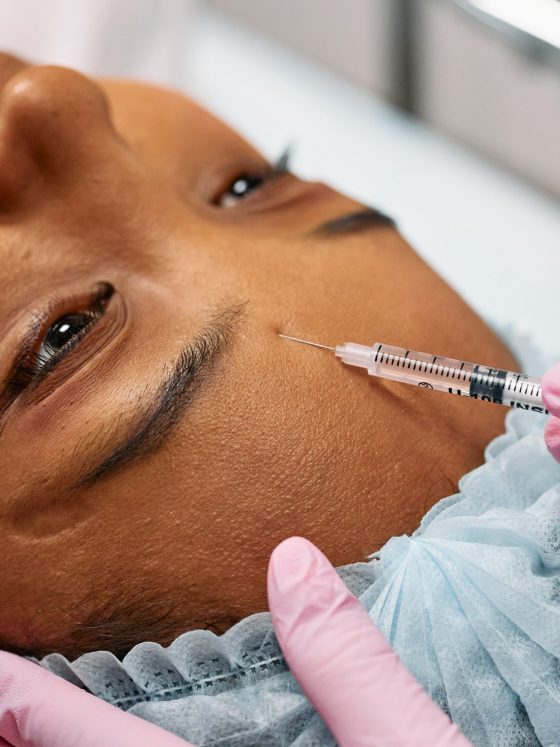 Surprising Botox Facts You Need to Know: Five Eye-Opening Revelations