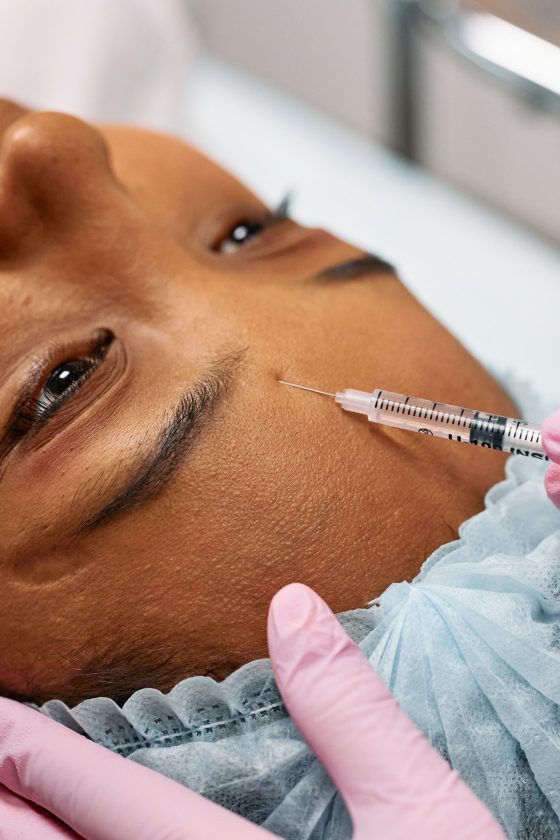 Surprising Botox Facts You Need to Know: Five Eye-Opening Revelations