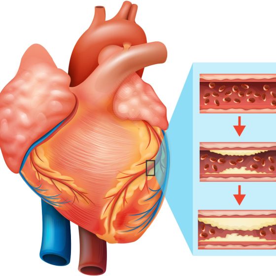 Top Five Natural Supplements for Maintaining Heart Health