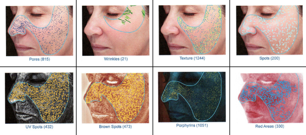 Visia Skin Analysis: Personalized Skin Care Treatment at Its Finest