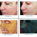 Visia Skin Analysis: Personalized Skin Care Treatment at Its Finest