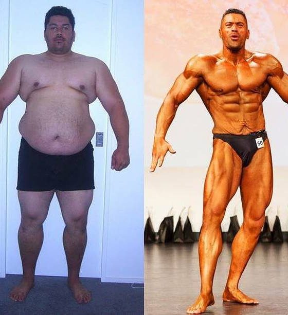 The Benefits of Opting for a Medical Weight Loss Plan